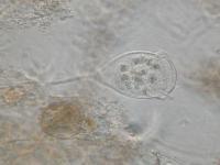 ボルティセラの顕微鏡写真