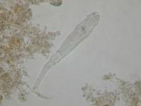ロタリアの顕微鏡写真